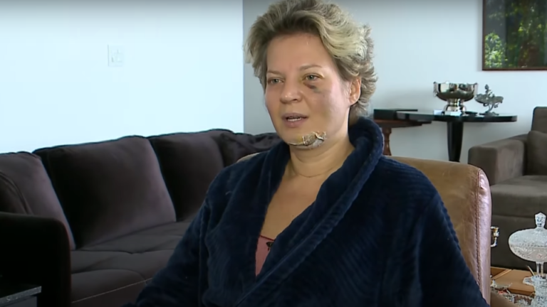 Joice Hasselmann diz ter sido vítima de “atentado”; deputada sofreu fraturas