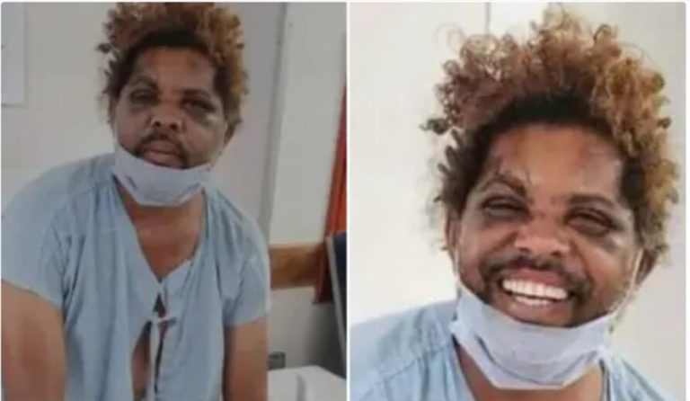 VÍDEO: O mais famoso mendigo do Brasil frustra “furo exclusivo” de reportagem de site nacional